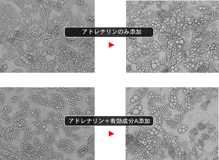 ラット初代内臓脂肪細胞を用いた脂肪放出促進効果の検討試験